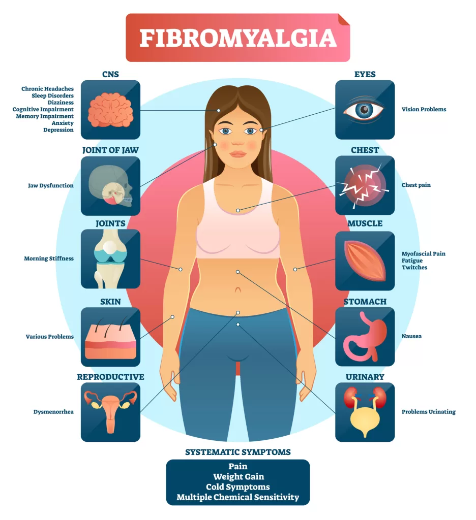 Fibromyalgia Systematic Symptoms Diagram scaled 1 936x1024 jpg - 8 Essential Tips for Managing Fibromyalgia Symptoms